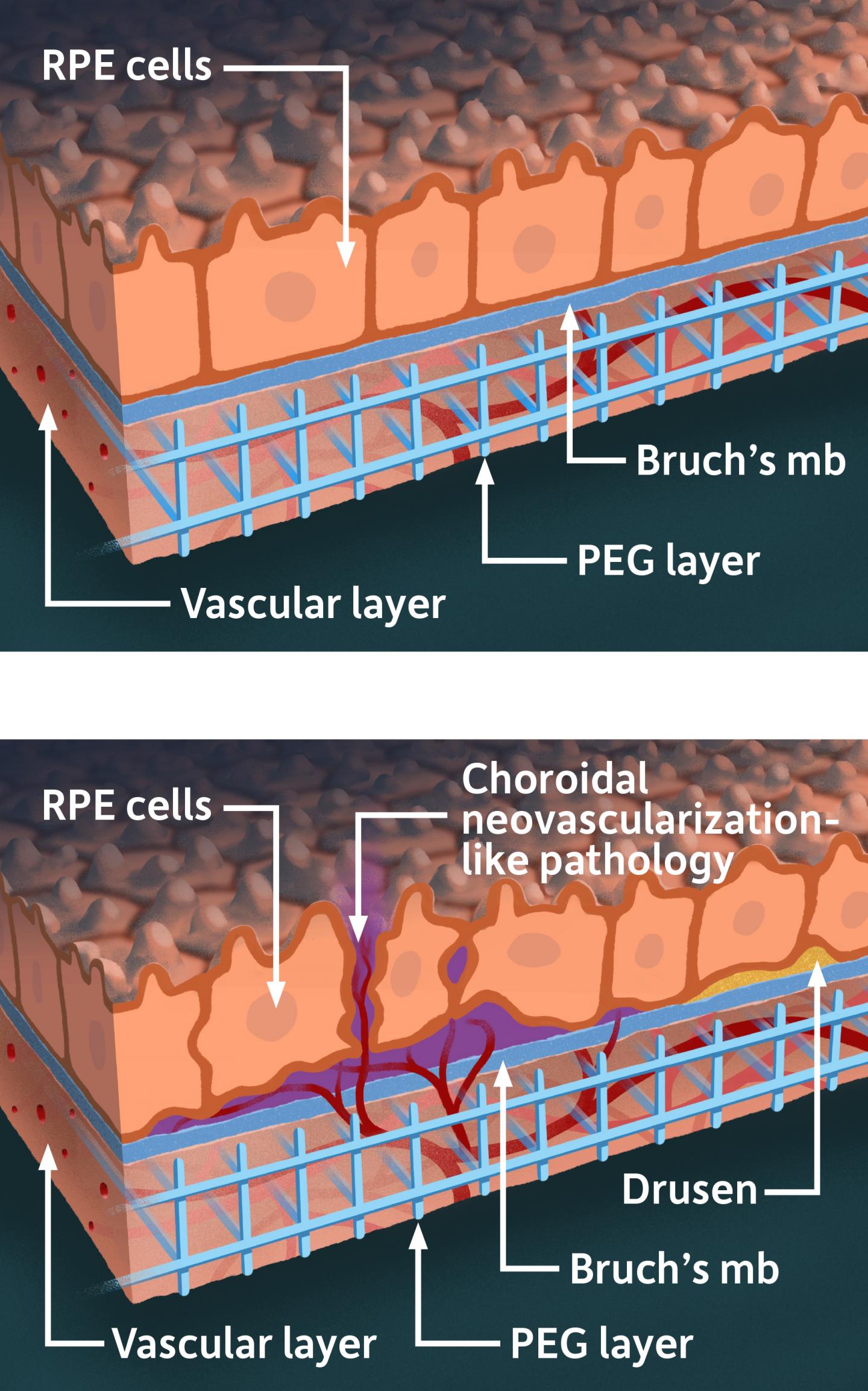 Singh-Benoit-retina-model