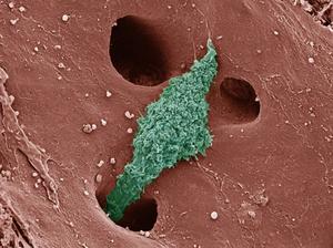 Kupffer cell in liver