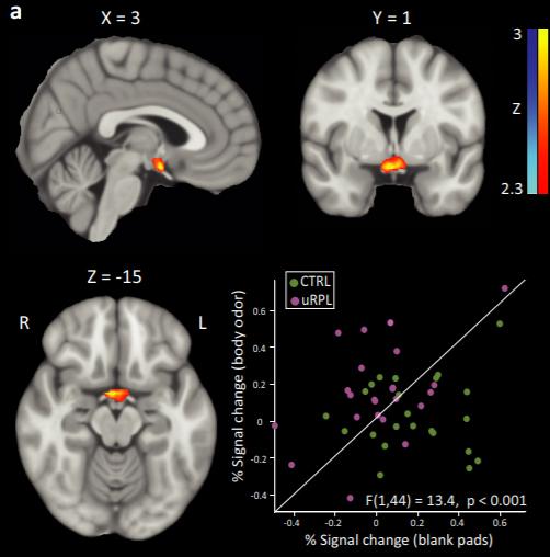fMRI Images