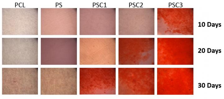 Bone Differentiation Image