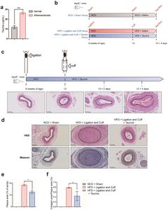 Effects of taurine on plaque formation and stability in atherosclerotic mice