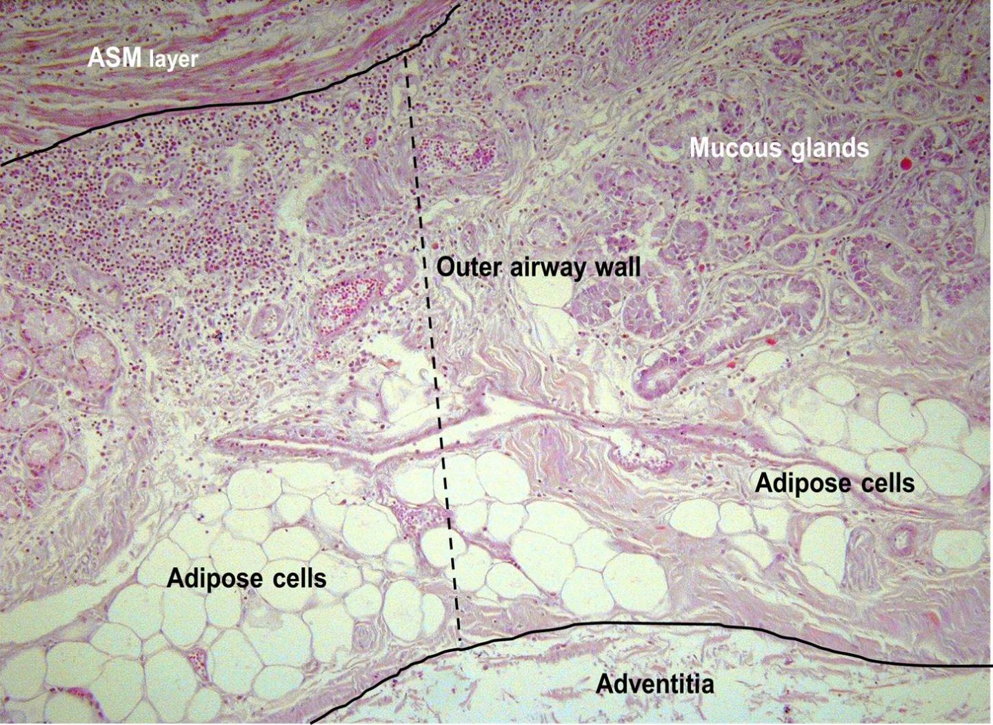 Figure 1A