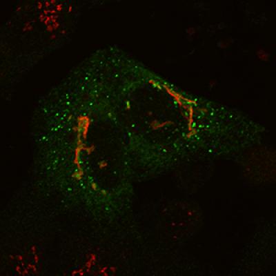 Surprising Culprit Found in Cell Recycling Defect -- Mutant Cell
