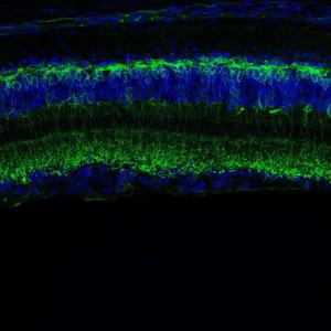 Ziapin2 effectiveness in restoring retinal function in preclinical models of retinitis pigmentosa and macular degeneration