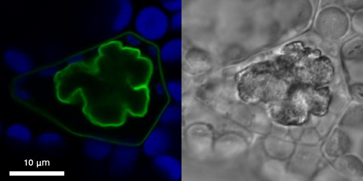 An oil body in a cell of the liverwort