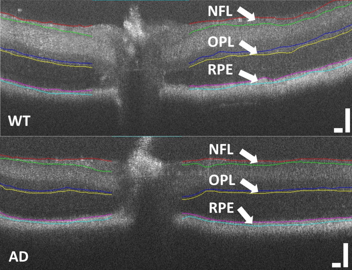 retinal layers oct