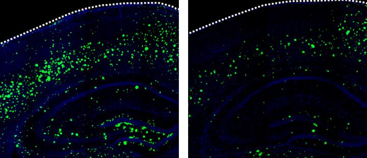 3K3A-APC Suppresses Amyloid-&#946; Accumulation