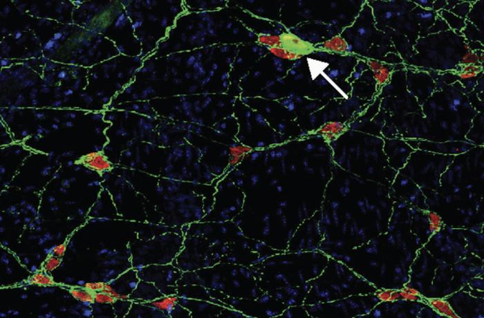 Damaged Neurons in GI Tract