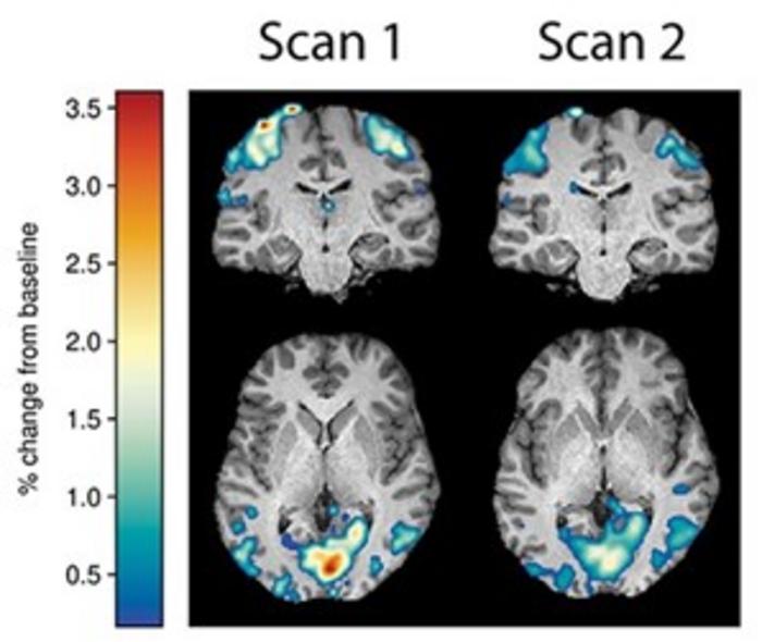 CerCor brain scans 2023 imaging research