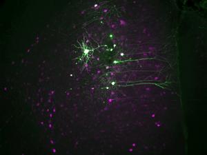 Anti-Anxiety and Hallucination-Like Effects of Psychedelics Mediated by Distinct Neural Circuits