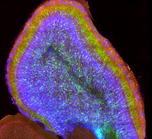 Section of a mouse brain observed using a fluorescence microscope.