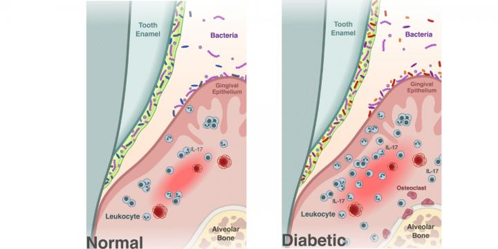 Diabetes and the Oral Microbiome