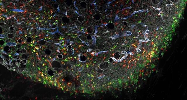 Mouse Tumor being Infiltrated by cDC1 Cells