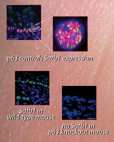 p63 and Satb1 Expression