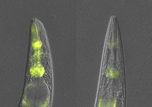 During failure of core protein quality control in the nematode C. elegans, a specialized anti-aggregation mechanism relying on pathogen response factors and lysosomal mediated degradation is triggered