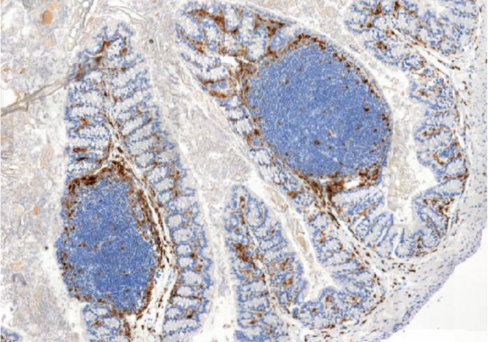 Section of intestinal tissue with staining of immune cells.