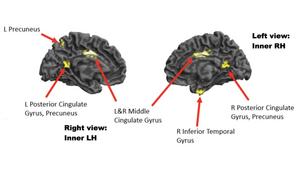 Inner views of left & right sides of brain