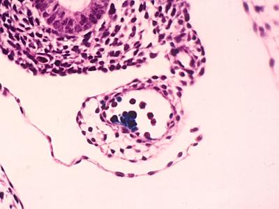 Birth of Hematopoietic (Blood) Stem Cells