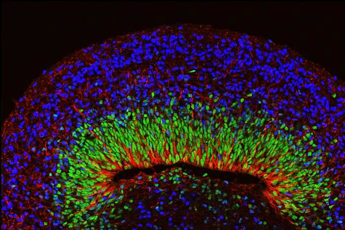 mini brain organoid