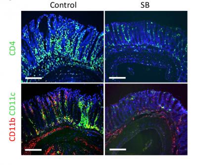 In a Mouse Model for Colitis, a Diet Supplemented with Butyric Acid Leads to Decreased Infiltration