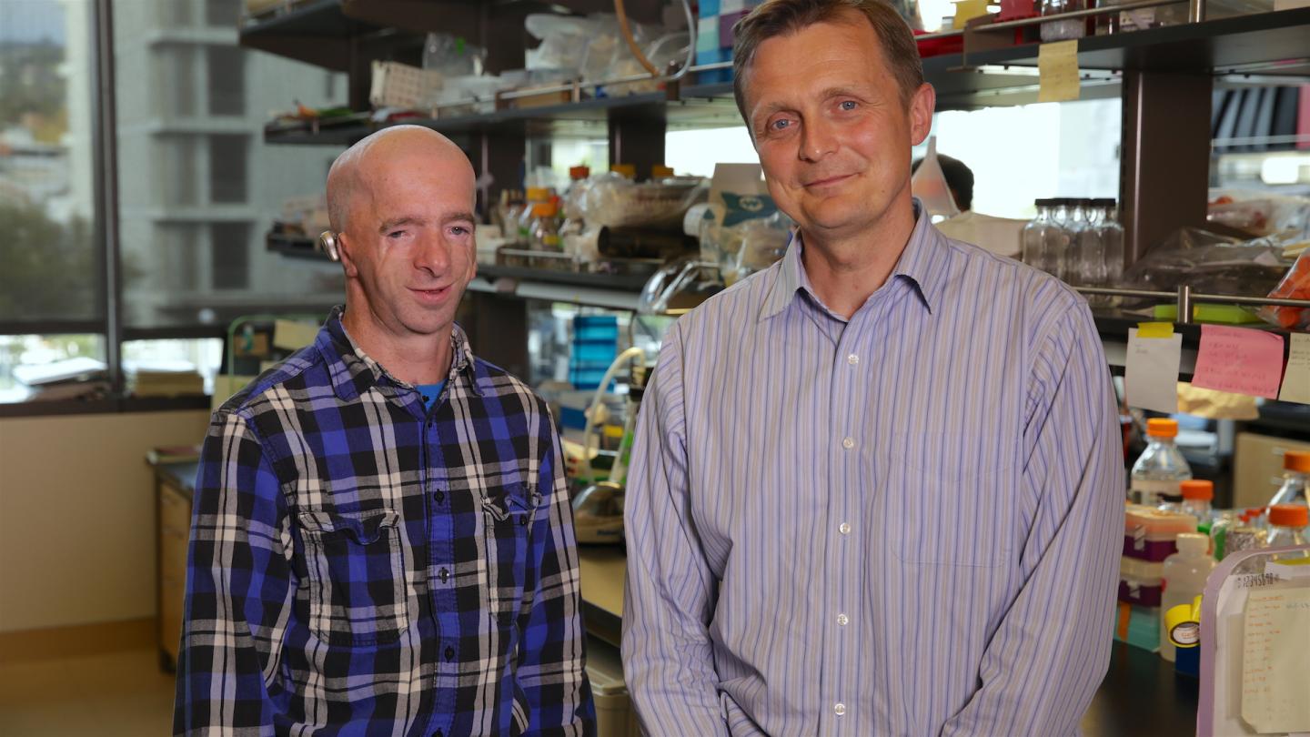 Treacher Collins Syndrome