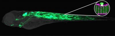 How Muscle Cells Seal Their Membranes