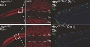 treatment with diazoxide reduced Aβ pathology in mice with Alzheimer's disease