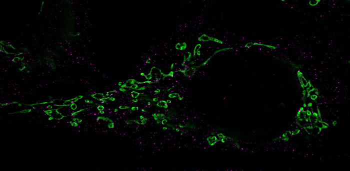 Mitochondria Fragmentation