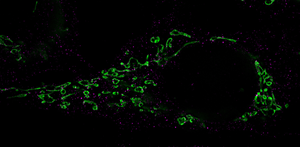 Mitochondria Fragmentation