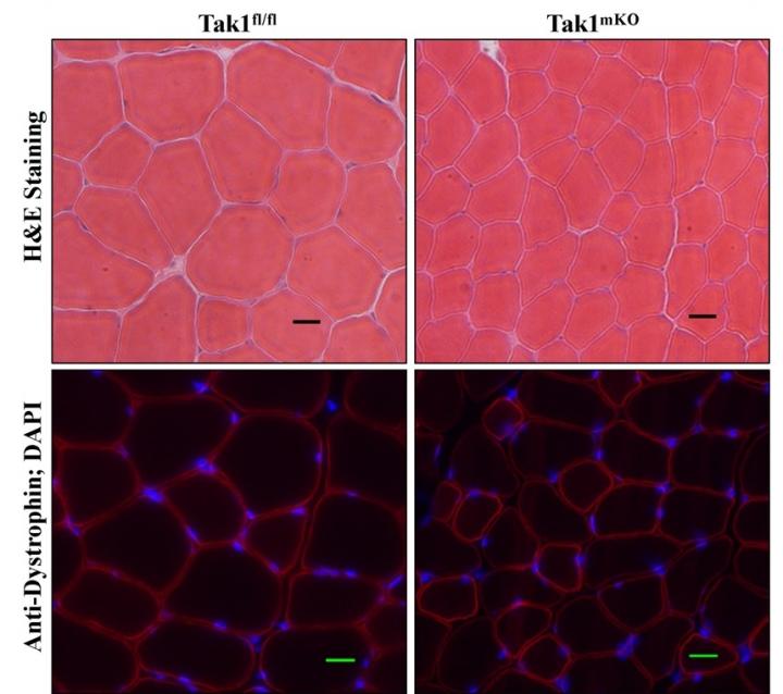 Control and TAK1-inactivated Tibialis Anterior Muscle