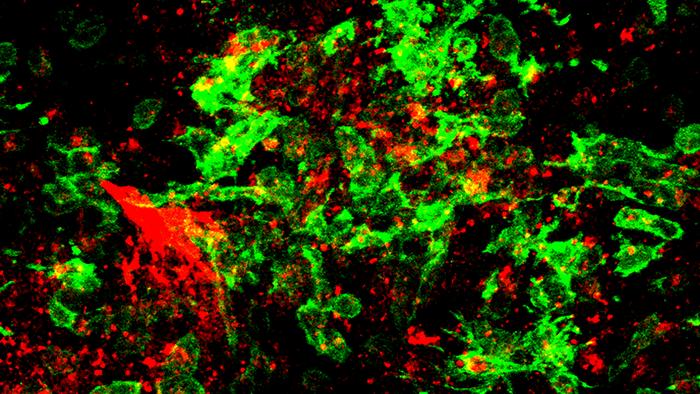 Inhibiting fibrin protects neurons from harmful inflammation after COVID-19 infection