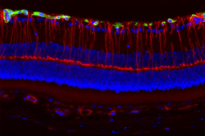 Fluorescent Retinal Cells