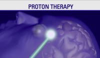 Proton Therapy Saves Critical Areas of Body