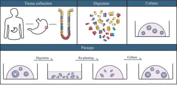 Key steps of organoid construction