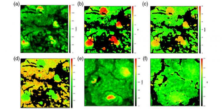 Imaging Hydroxyapatite in Sub-Retinal Pigment Epithelial Deposits
