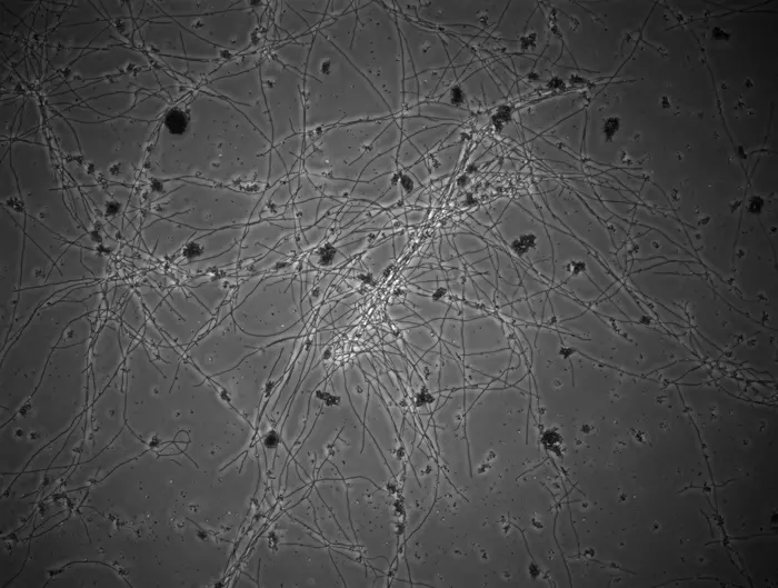 Talaromyces verruculosus under the microscope