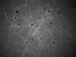 Talaromyces verruculosus under the microscope