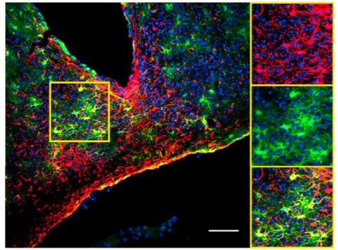 Astrocytes in Master Clock Light up When Expressing Clock Genes