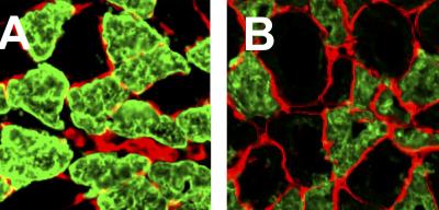 Effects of Mutated Titin