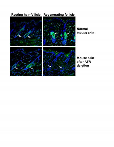 Loss of Stem Cells Correlates with Premature Aging
