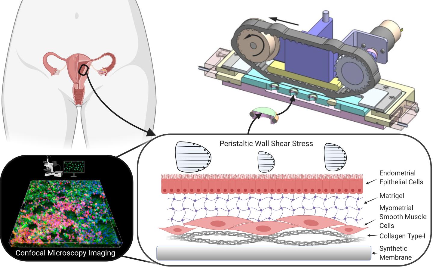 Scheme of the Tissue Engineered Endometrial Barrier Model