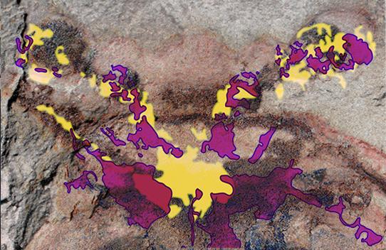 Overlay of Brain Structures