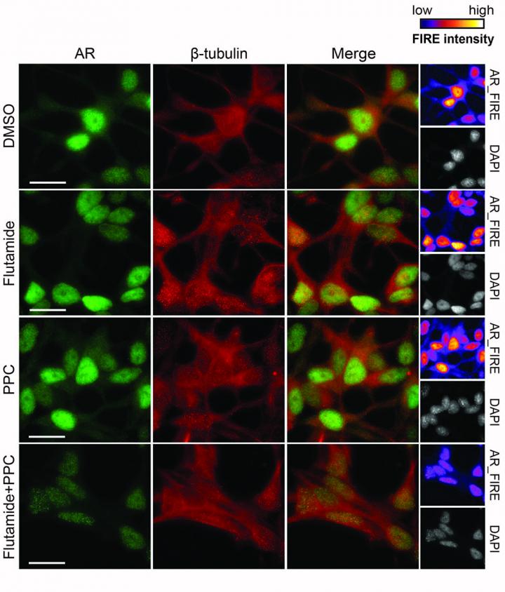 Prostate Cancer Cells Treated with Flutamide and PPC