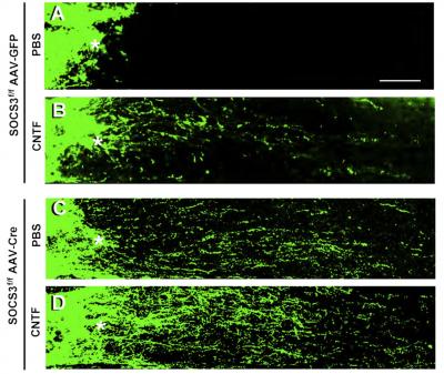 Regenerating injured nerve fibers