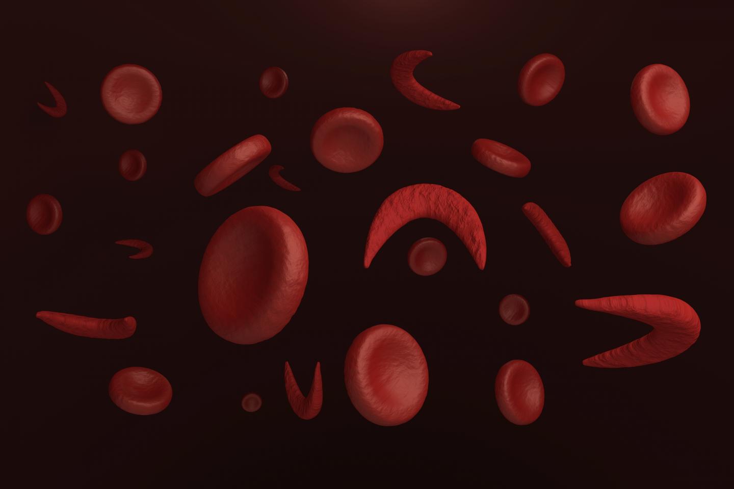 Hydroxyurea and Sickle Cell: ATS 2016 International Conference