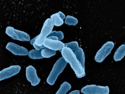 Soil Holds Clues to Antibiotic Resistance (1 of 4)