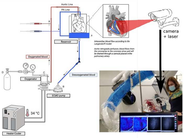 The proposed imaging technique detects speckle patterns to visualize blood circulation in hearts preserved by ex situ heart perfusion (ESHP).