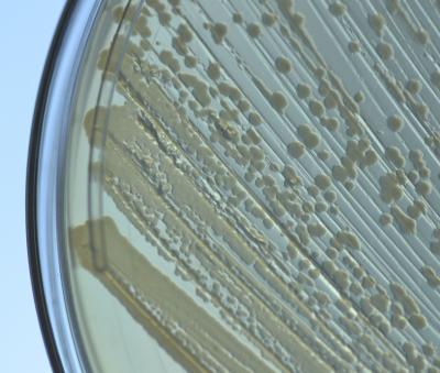 <i>E. coli</i> on Petri Dish