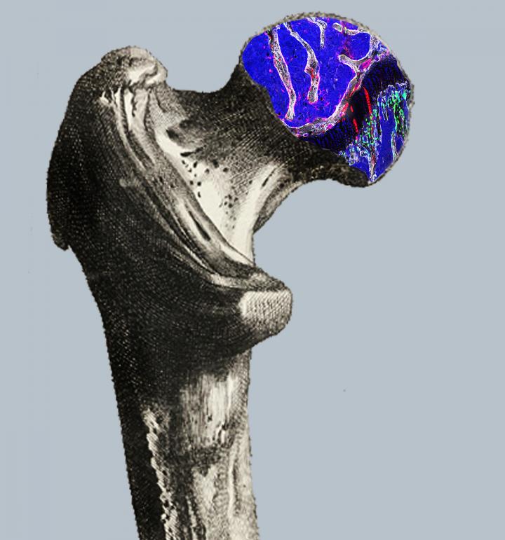 Head of a Femur