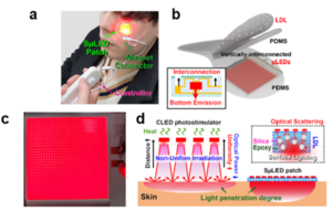 The overall concept of SµLED patch